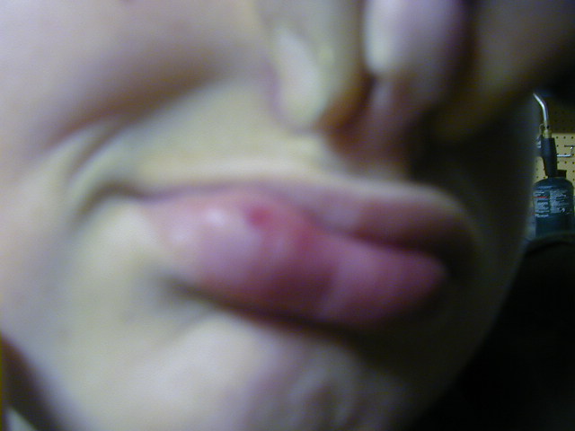 lipmax.jpg
